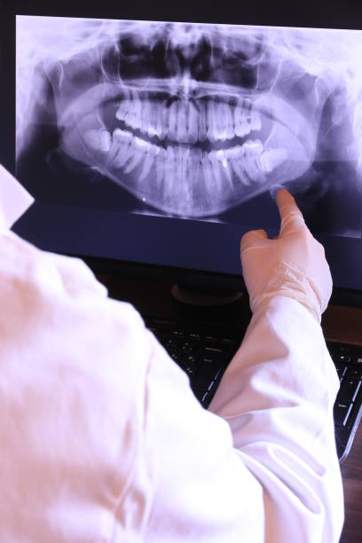 Best Emergency Dentist for Lost Fillings or Crowns in Laurel Hill, NC
