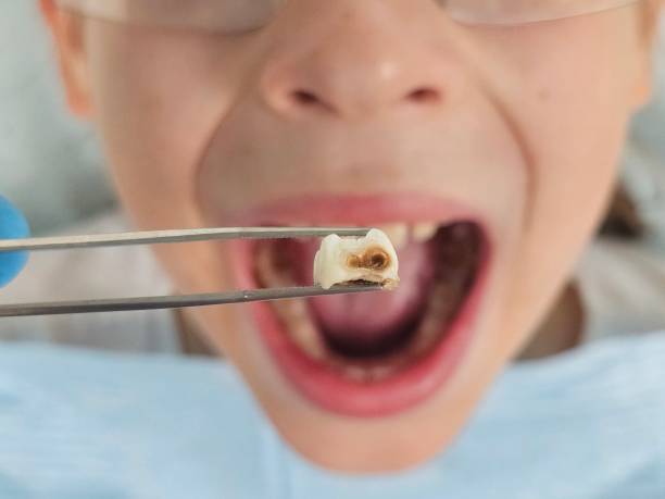 Best Mobile Emergency Dentist in Laurel Hill, NC