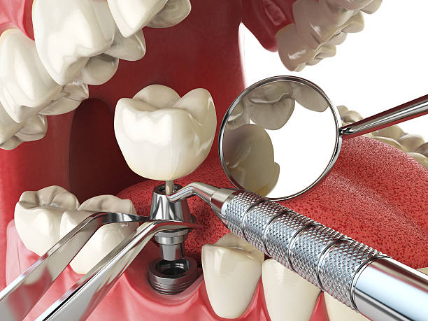 Best Orthodontic Emergency Dentist in Laurel Hill, NC