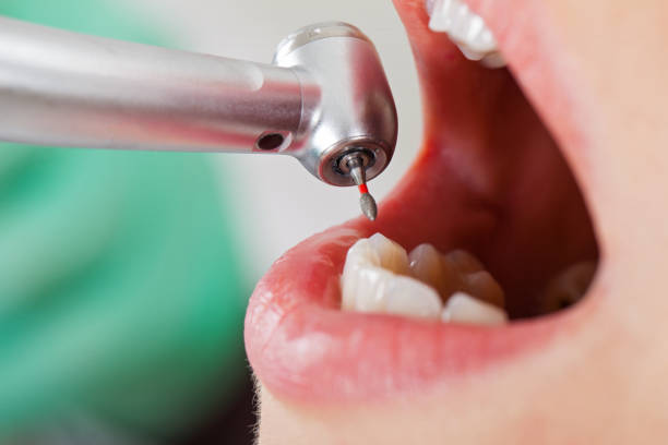 Best Holiday Emergency Dentist in Laurel Hill, NC